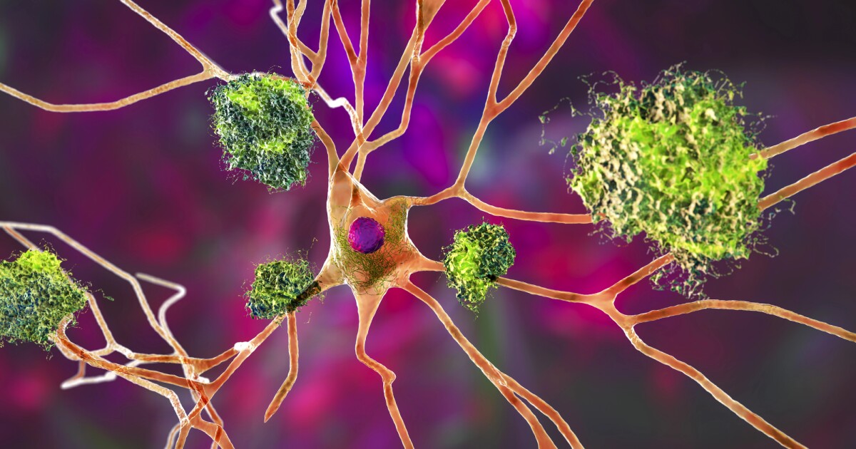 Notorious Alzheimer’s protein also supercharges cells against cancer