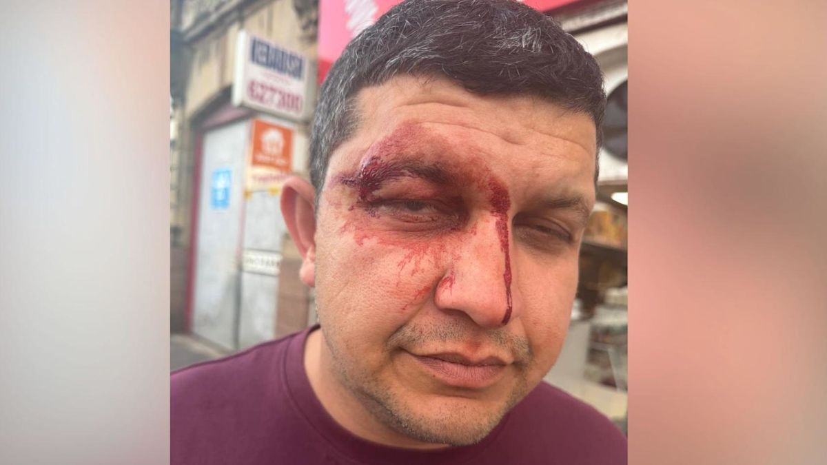 Gang of men hurl racist abuse at takeaway owner before violent attack