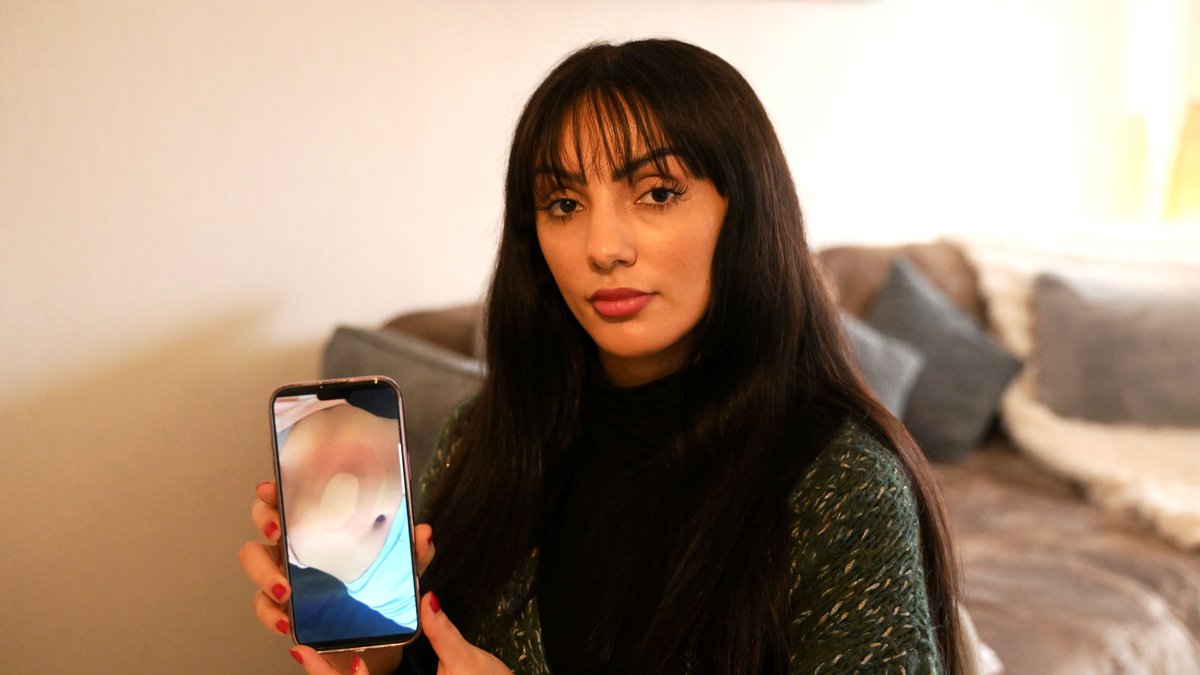 "Mannequin, c’était ma passion, tout s’est arrêté" : une ancienne Miss, brûlée lors d’une séance de cryothérapie, réclame justice