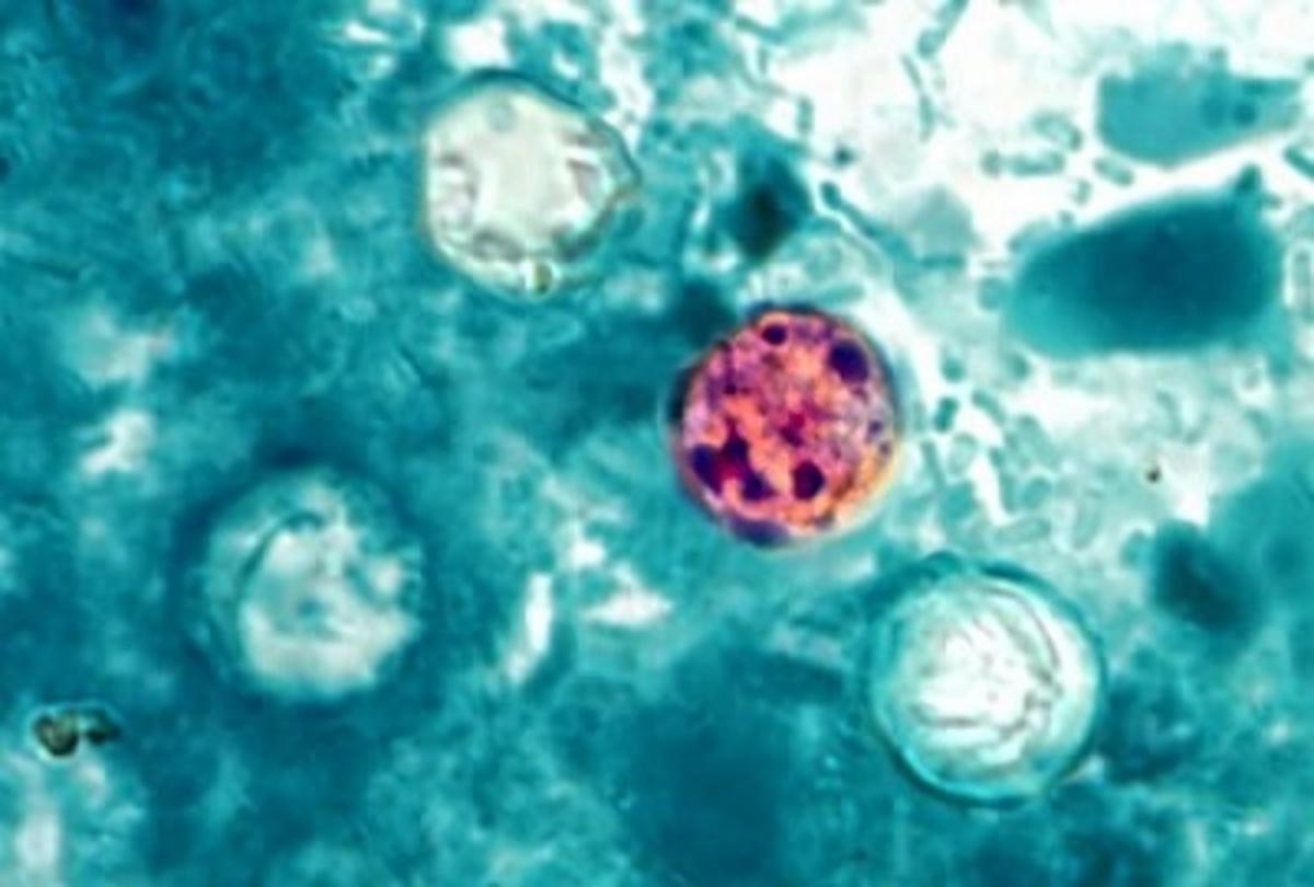 NY Alert: FDA Looking For Source Of  New Cyclosporiasis Outbreak