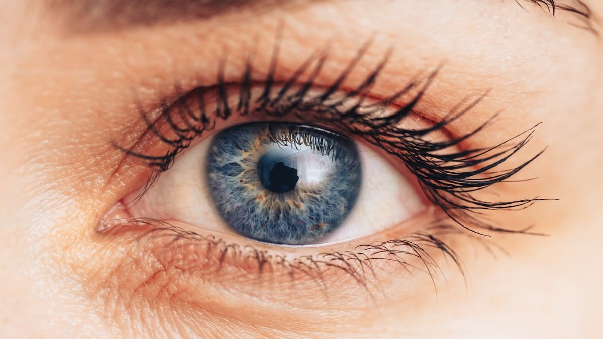 Studie zeigt - Flügelfell am Auge mit Hautkrebs verknüpft