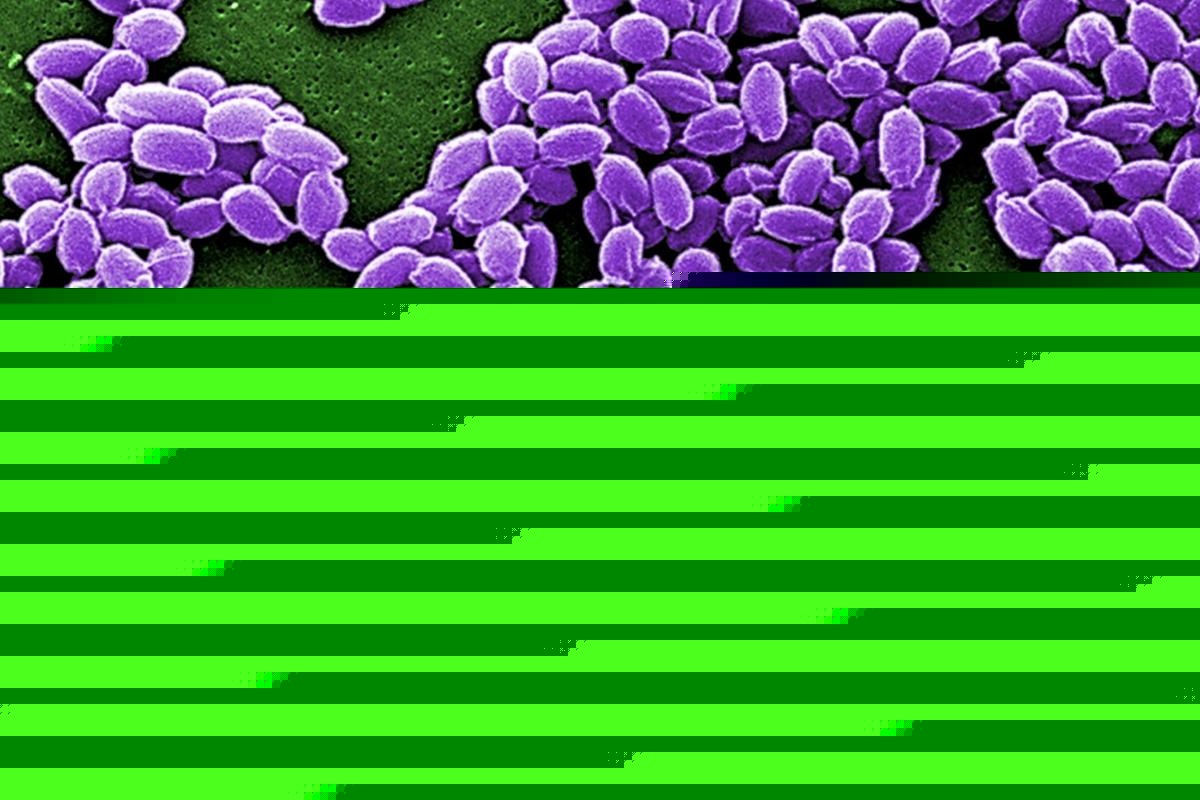 Washington on Alert: Drug-Resistant Infections Rising In The U.S.