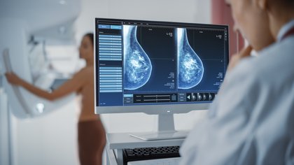 La impactante revelación sobre las mamografías asistidas por IA que podría cambiar reducir las tasas de cáncer de mama