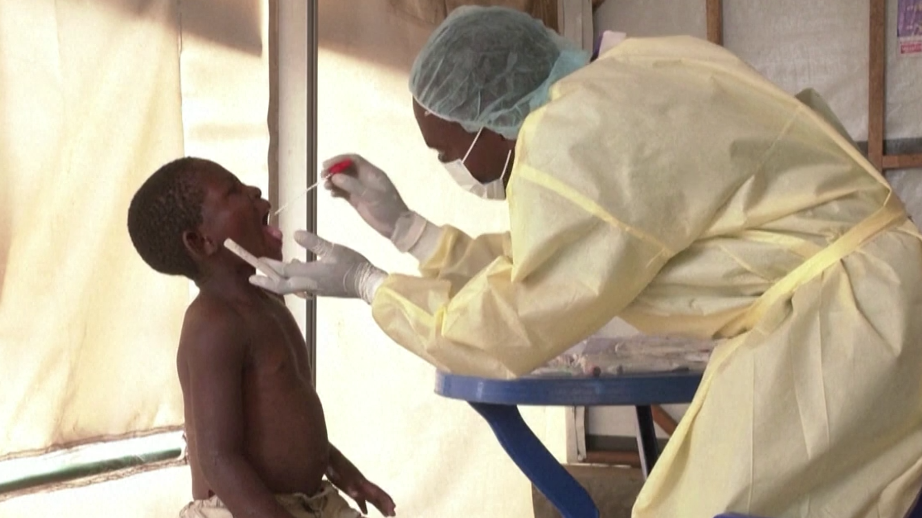 Deux nouveaux cas de mpox à Mayotte, la ministre de la Santé interpellée à la Réunion