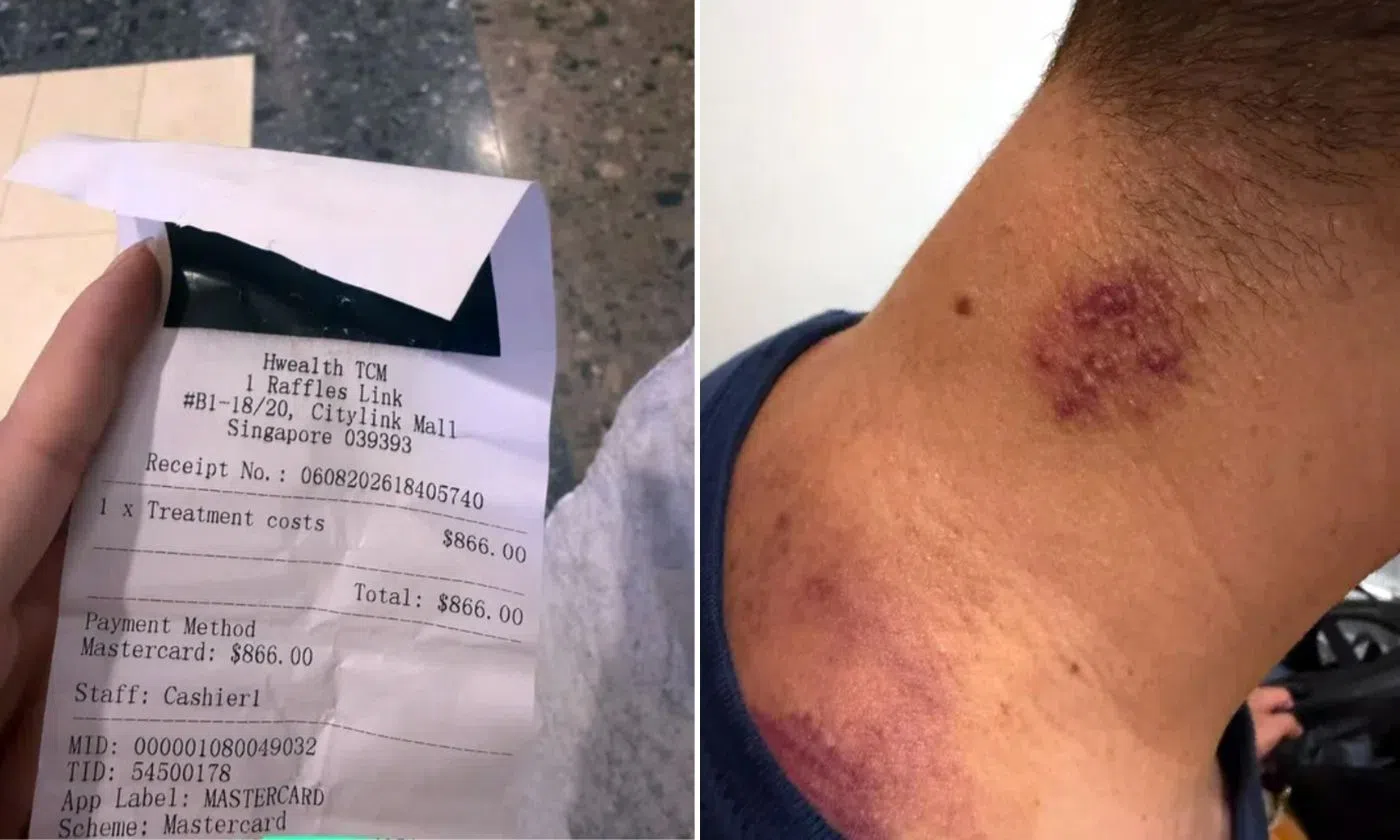 Tourists visit TCM clinic for stiff neck, end up paying nearly $1,000 after allegedly being upsold treatments