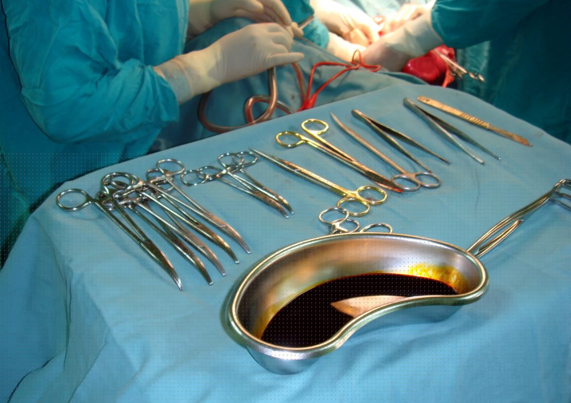 Comment on Kidney transplant at BMH saves 2.3bn/- for Govt by เช็คสลิปโอนเงิน