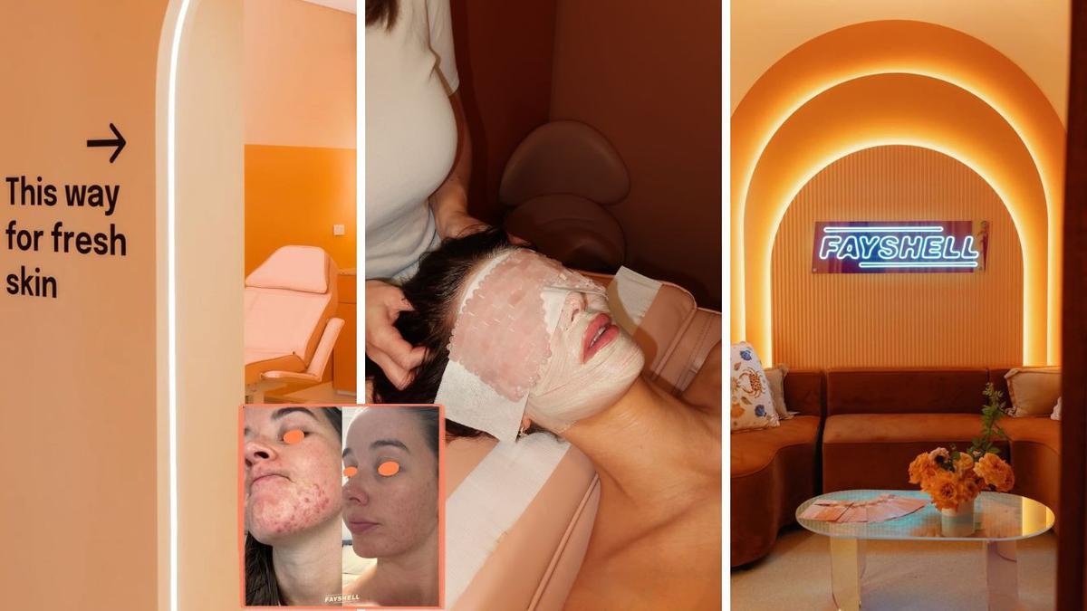 This $199 personalised skin treatment could be the smartest beauty buy you’ll make this year