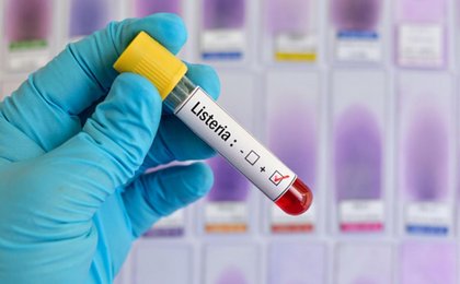 Fatal Listeria Outbreak Linked To Foods At Walmart, Trader Joe's