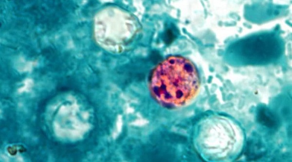 Michigan Reports Two Deaths in Cyclospora Outbreak