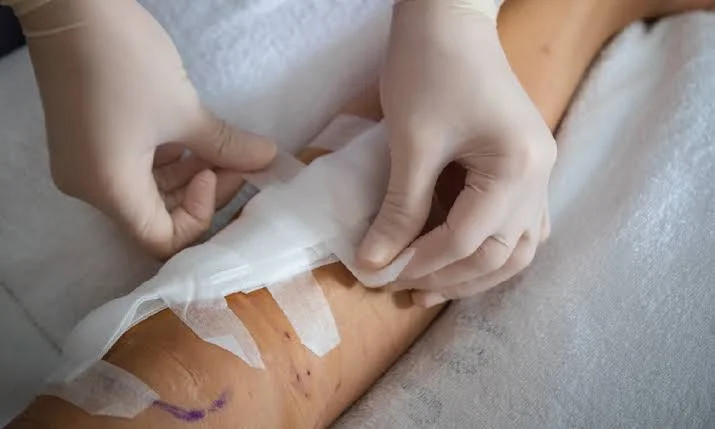 Plant-based wound dressing fights infection before it takes hold