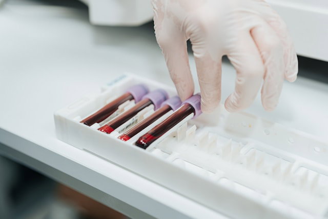 Hidden DNA Changes May Predict Blood Cancer Years Before It Worsens