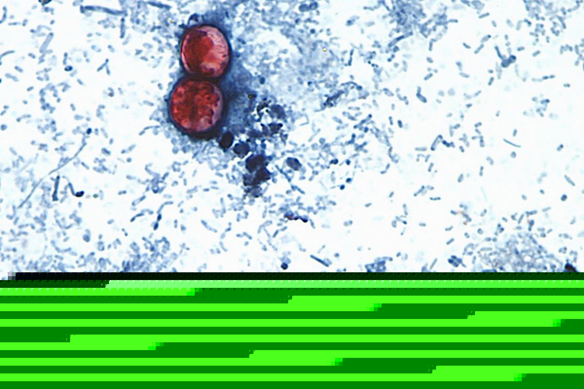 Michigan reports the first 2 US deaths related to a diarrhea-causing parasite