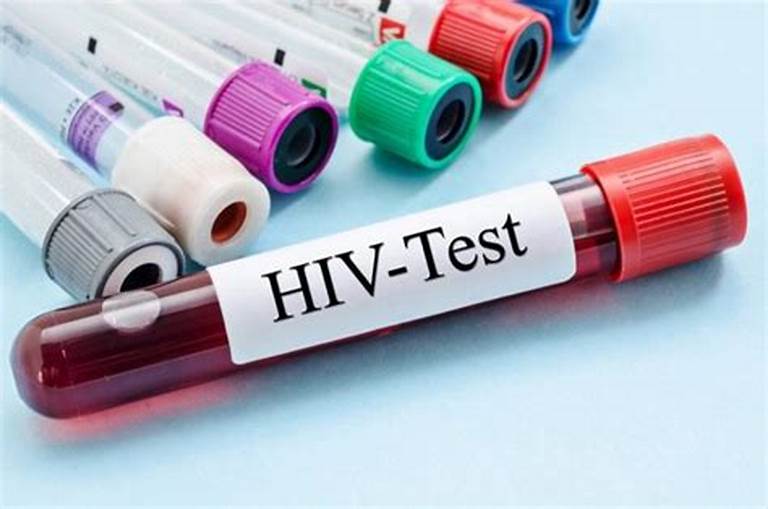 AIDS Secretariat Offers Free Late-Night HIV Testing After Carnival