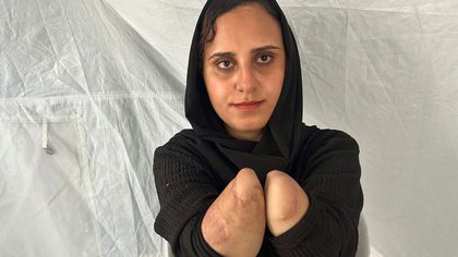 Gaza: Nibal al-Hissi hat beide Hände verloren, ihr Ehemann hat sie verlassen, nun kämpft sie um ihre Tochter