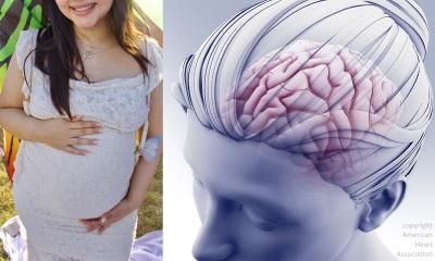 Pregnancy puts stroke survivors at increased risk of recurrence