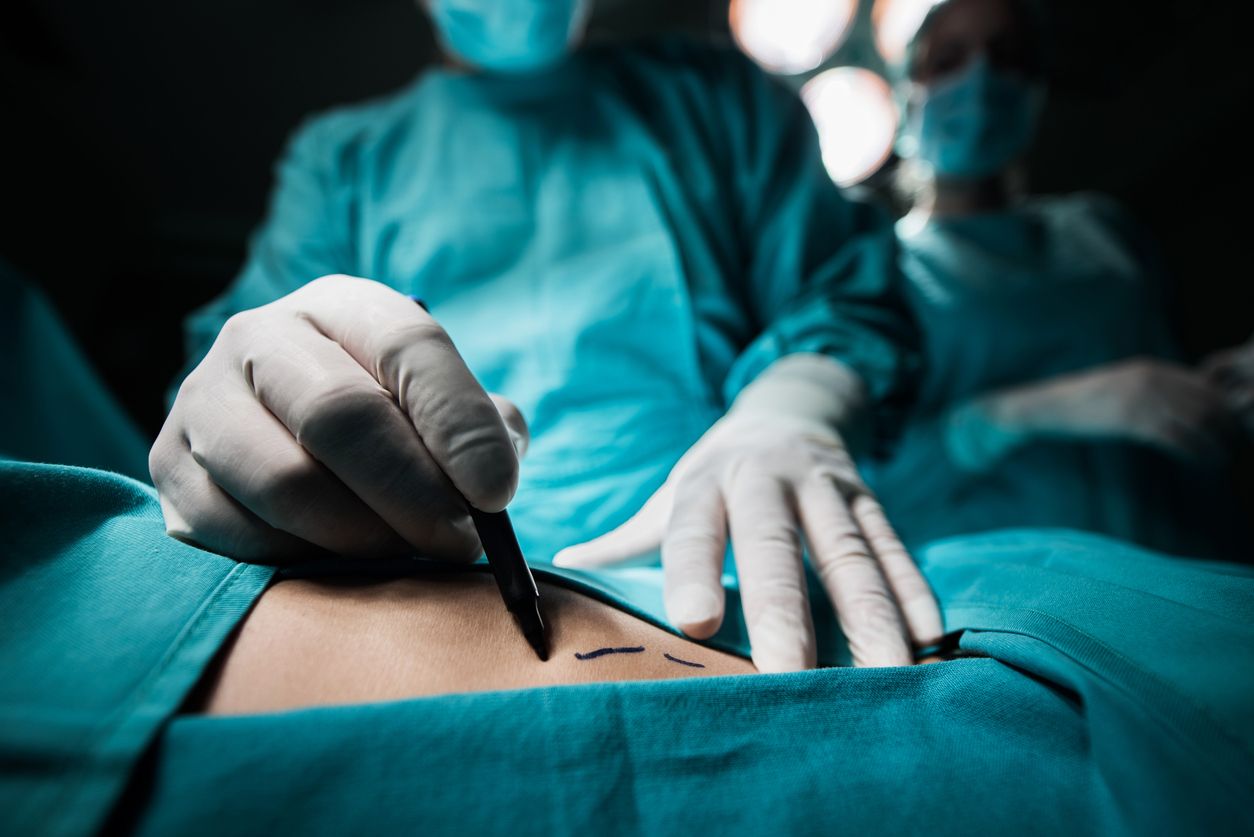 The Robot Surgeon In Testing Phase