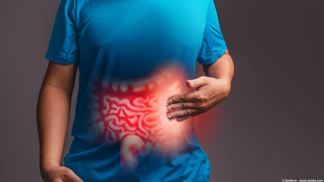<![CDATA[Esophageal Cancer, From Diagnosis to Treatment]]>