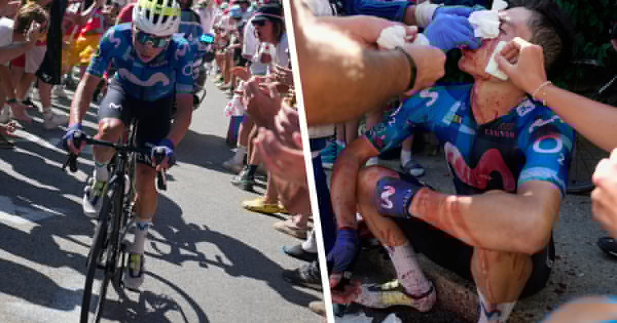 Ausfall bei der Tour - Horrorverletzung nach Sturz mit 20 Stichen genäht