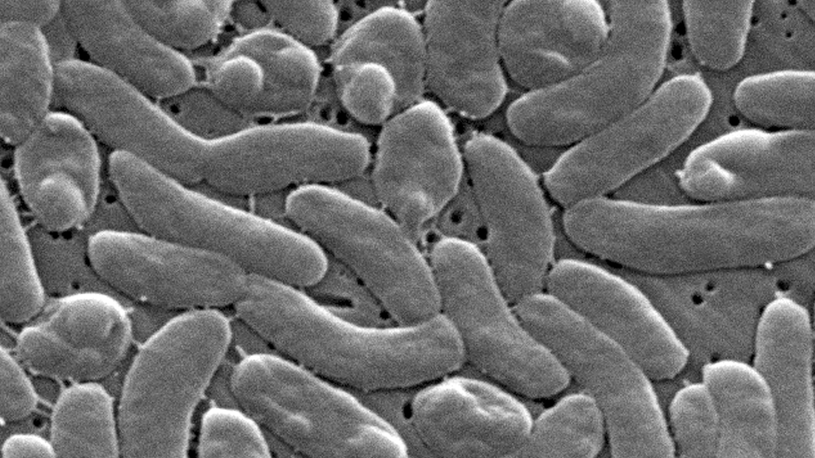 Health officials urge caution for Gulf Coast beachgoers during surge of deadly bacterial infections