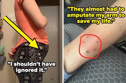 People Who Ignored Their Health Problems Are Sharing What They Wish They Paid Attention To Sooner
