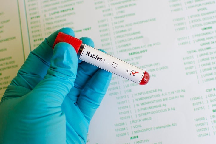 Two Animals Test Positive for Rabies in Separate Aiken County Locations