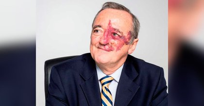 Mariano Barbacid: ¿Quién es el oncólogo español que habría encontrado la cura al cáncer de páncreas?
