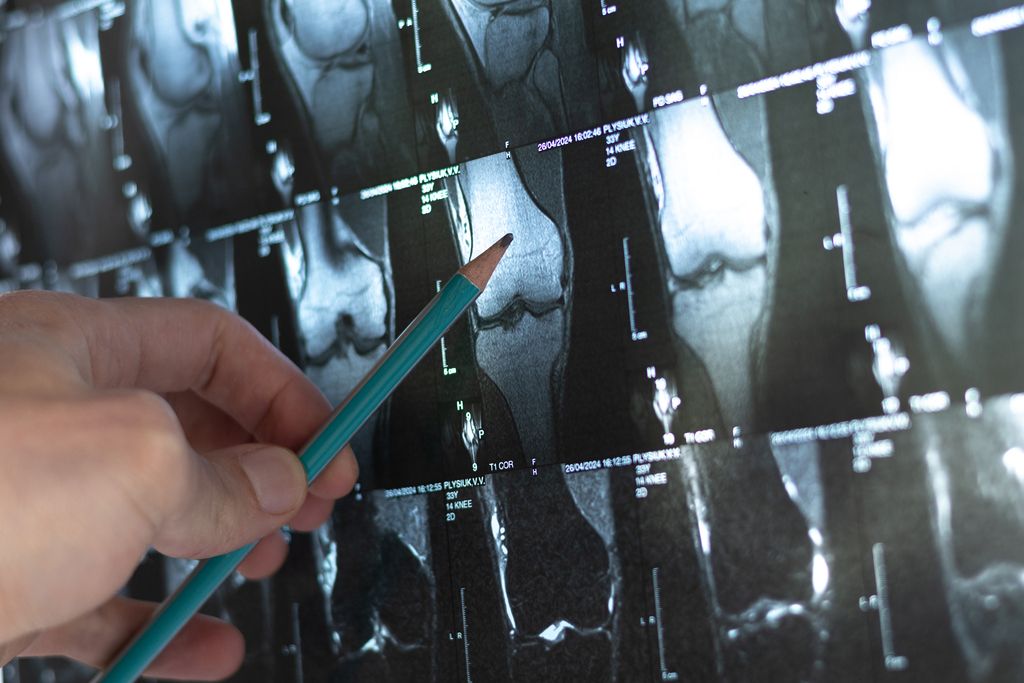 Medical staff concerned Alberta's new testing regime may leave them overwhelmed