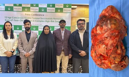 12 Kg Cancerous Gastric Tumour Successfully Removed from a 67-Year-Old Ethiopian Woman in a Rare, High-Risk Surgery