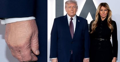 Trump, 79, Coats Hand in Makeup for Melania’s Big Premiere