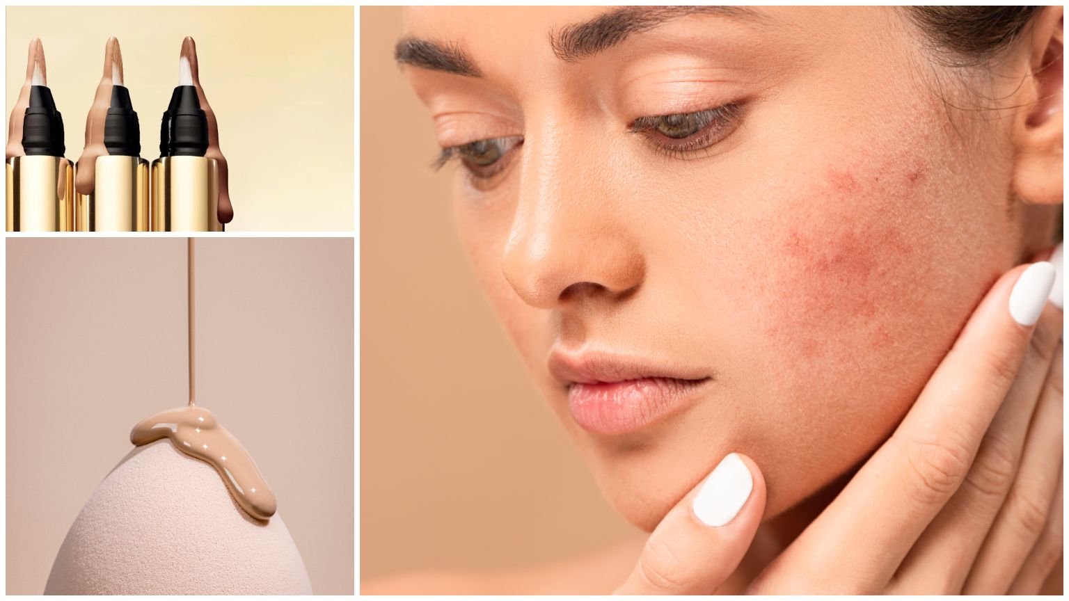 My Uneven Skin Tone Runs Red—This Makeup Routine Gives Me a Flawless Complexion