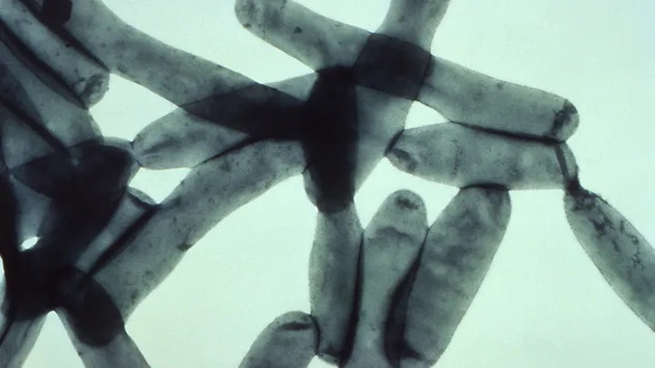 Two cases of Legionnaires’ disease reported in Bloomingdale rehab center: officials