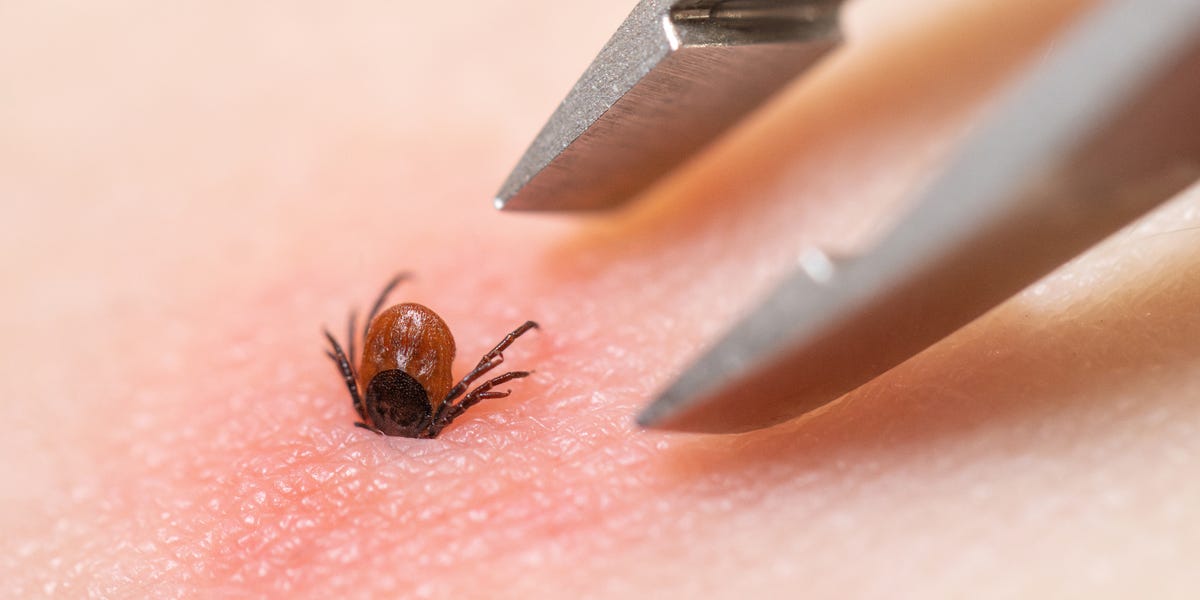 How to Handle a Tick Bite, According to Experts
