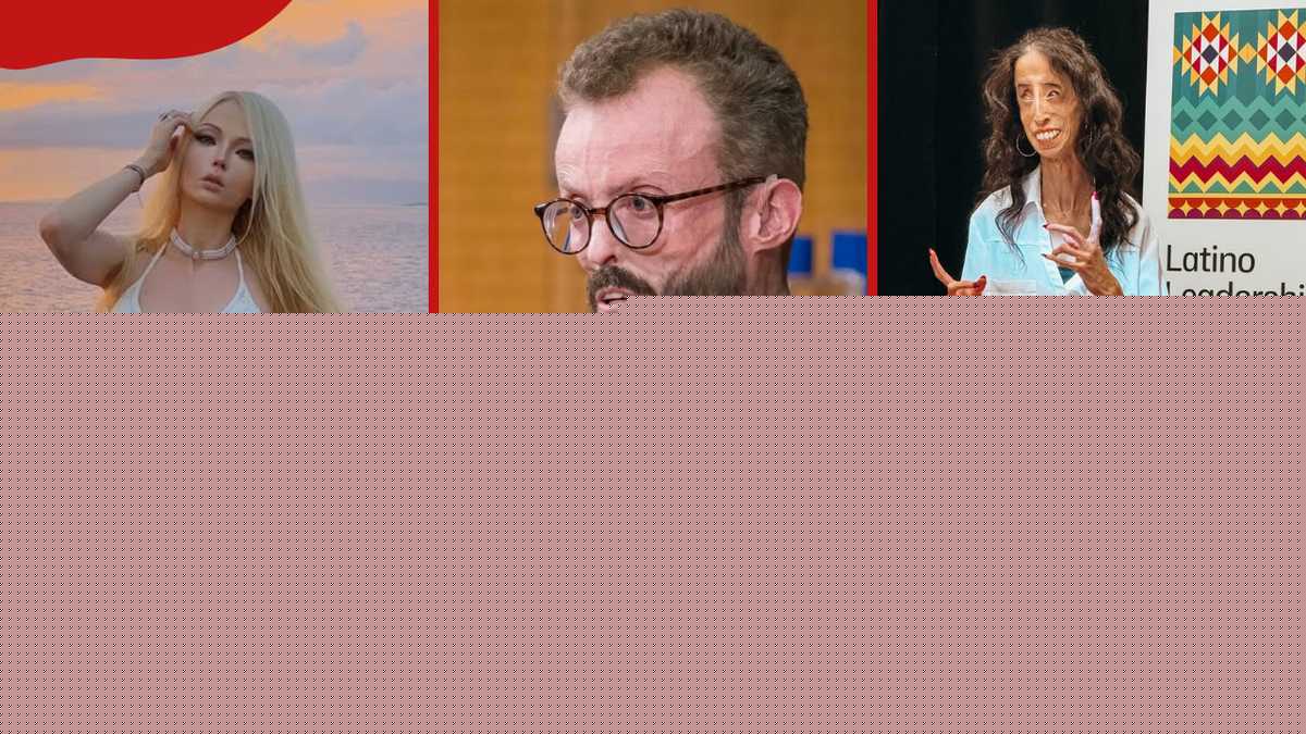 Meet the 9 skinniest people in the world and discover their stories, causes, and health conditions