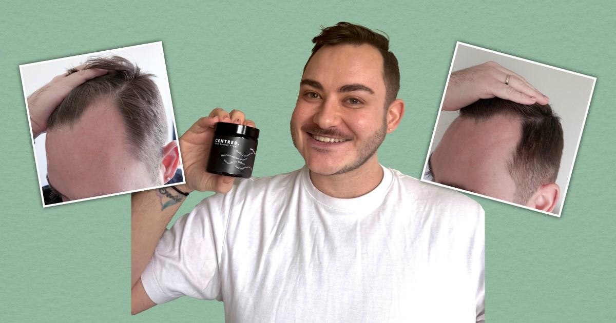 I’ve suffered from thinning hair, and this Centred supplement has brought it back to life