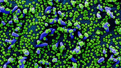 What Are The Symptoms Of The "Stratus" COVID-19 Subvariant That's Hitting The USA?