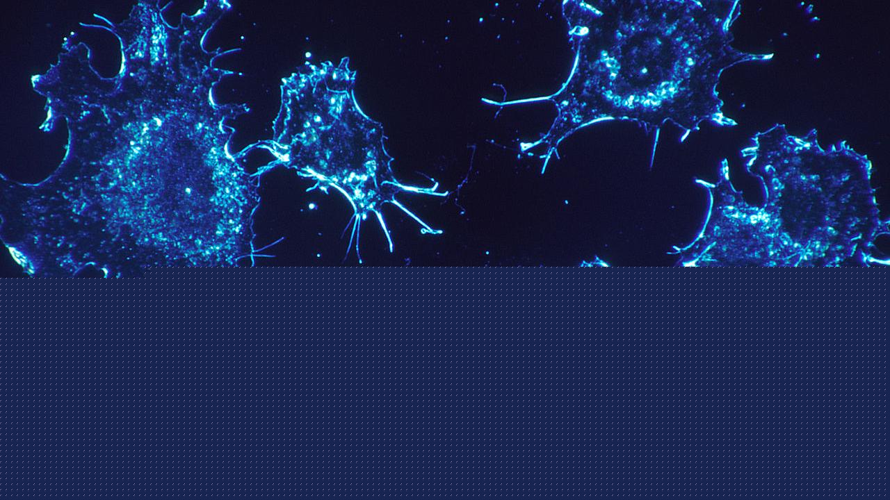 Excess body sugar helps cancer tumors hide from the immune system