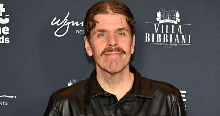 Perez Hilton in ‘serious but stable’ condition, will need surgery, family says