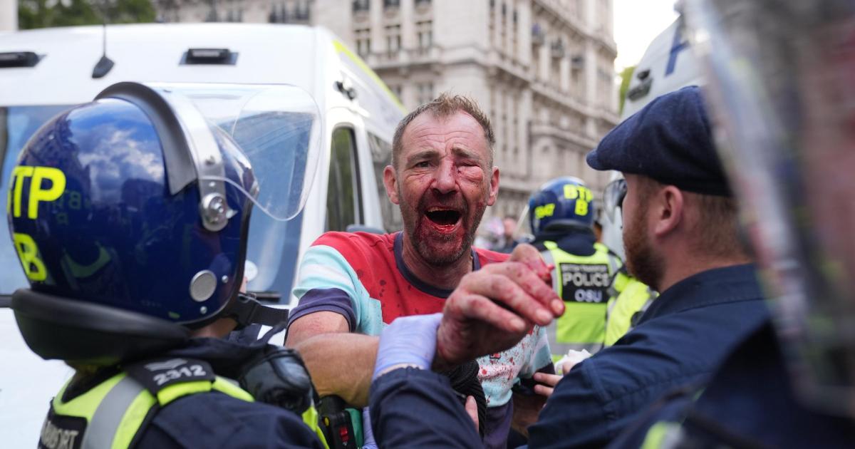 Police ‘assaulted’ and face ‘aggression’ from Tommy Robinson protesters