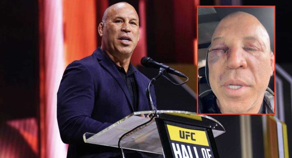 Wanderlei Silva lists horrific injuries and demands justice after ‘criminal’ attack left him out cold