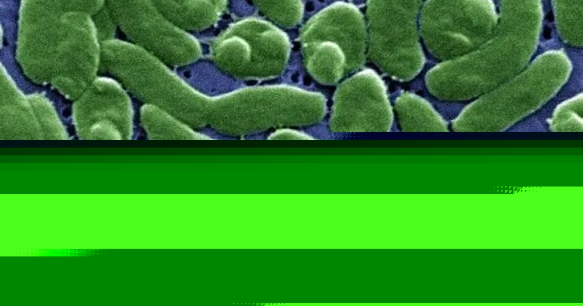 Case tracker: Here is where flesh-eating bacteria cases have been reported in the US