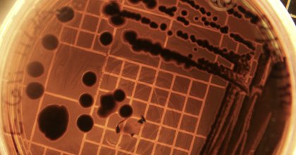 <a href="https://www.acsh.org/news/2026/01/29/bacteria-are-fearsome-especially-when-weaponized-49934" hreflang="en">Bacteria are Fearsome, Especially When Weaponized</a>