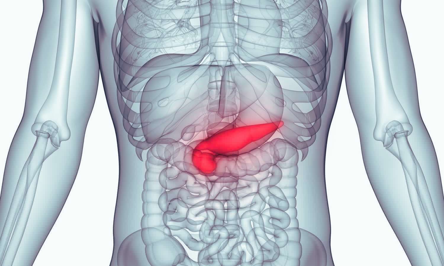 One-Third of Acute Pancreatitis Cases Have Nonalcoholic, Nonbiliary Causes, JAPI Study Finds