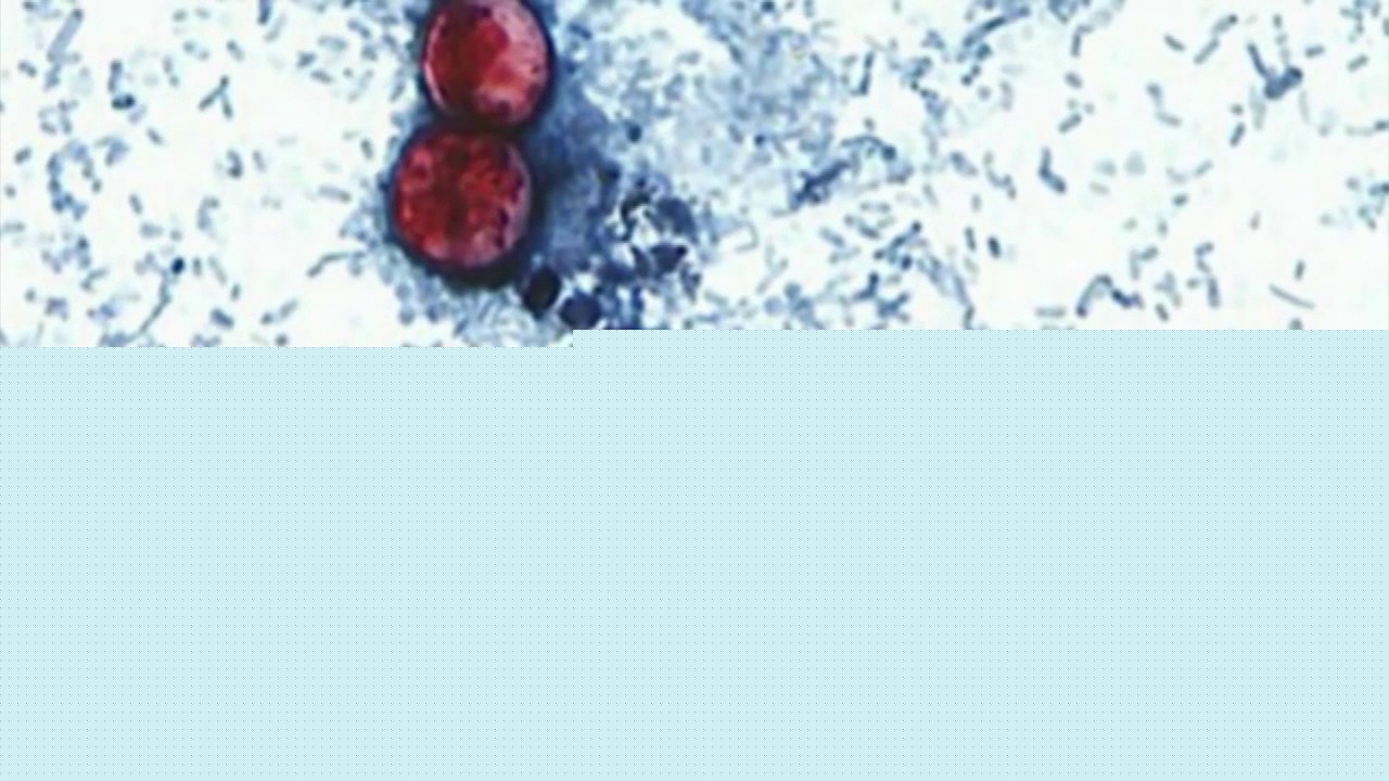 2 deaths linked to massive Cyclospora outbreak
