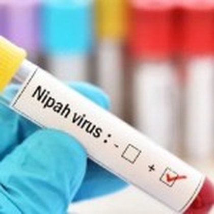 SSM calls for vigilance as Nipah virus cases emerge in India