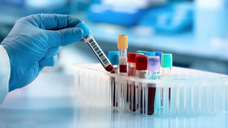 Ünlülere yönelik uyuşturucu soruşturması: Dört ismin testi pozitif çıktı