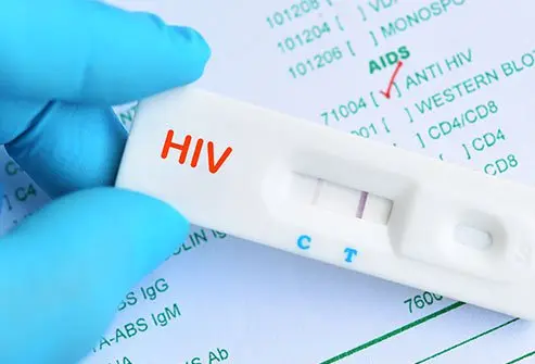 Fact Check: Is HIV Testing Being Made Mandatory In Colleges?