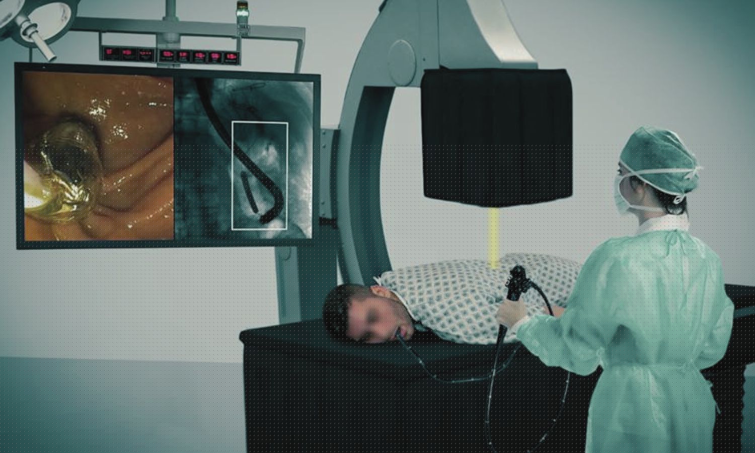 AI-Enabled Fluoroscopy System May Reduce Radiation Exposure to Endoscopy Staff: Study
