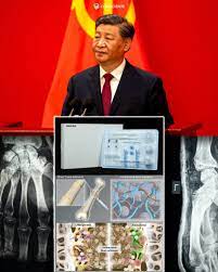 Bone Glue Bone-02: The Chinese Medical Revolution that Repairs Fractures in Three Minutes