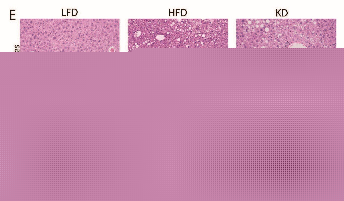 Popular keto diet linked to glucose intolerance and fatty liver in mice