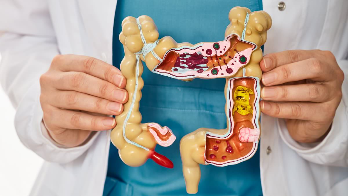 My stomach is constantly gurgling and bubbling and I've had to take Gaviscon for years... what's wrong with me? DR SCURR reveals what's going on - and the test you must ask your doctor for